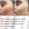 ⁦مناديل من مجموعة كلير آند غلو لتفتيح الكلف و البقع العنيدة 🌸✨⁩ - الصورة ⁦3⁩