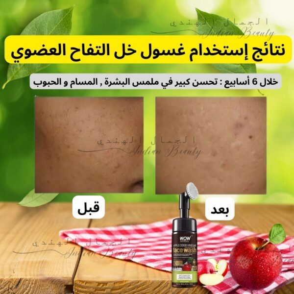 غسول خل التفاح العضوي للوجه 🍎