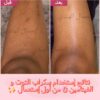 ⁦مقشر للجسم بتوت العليق مع أحماض ألفا هيدروكسي ، نياسيناميد / الفيتامين C⁩ - الصورة ⁦2⁩