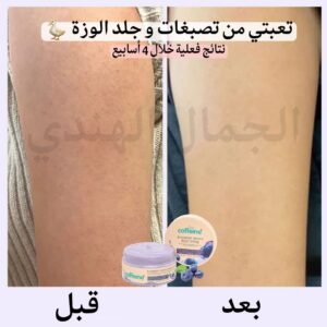 مقشر الجسم توت الأزرق بريز 🫐❄️